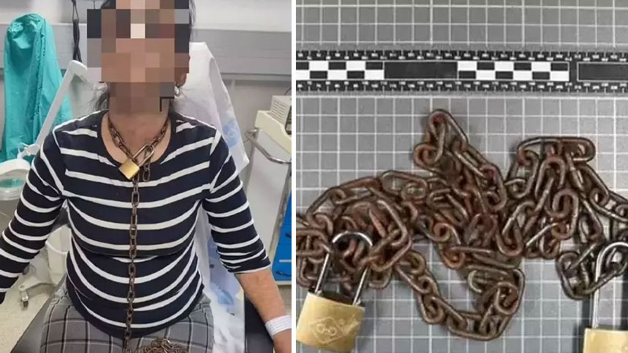 İspanya'yı ayağa kaldıran olay: Boynunda zincirlerle hastaneye koşan kadının anlattıkları şoke etti