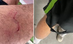 Sokak köpeklerinin ısırdığı sporcuya köpeksever kadından tepki!