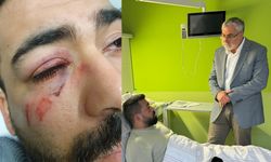 İsim benzerliğinin kurbanı oldu! Alman polisi Türk gencinin elmacık kemiğini kırdı