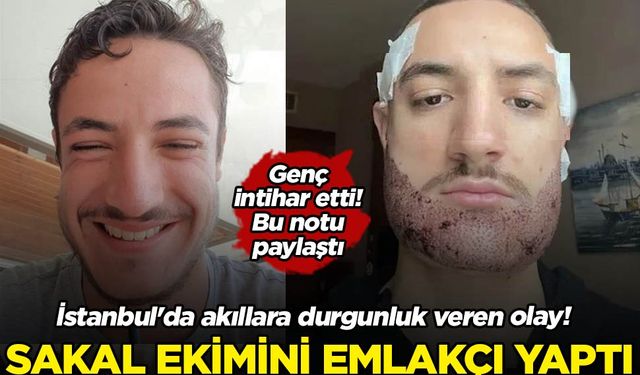 İstanbul'da akıllara durgunluk veren olay! Sakal ekimini doktor değil emlakçı yapmış! Genç intihar etti