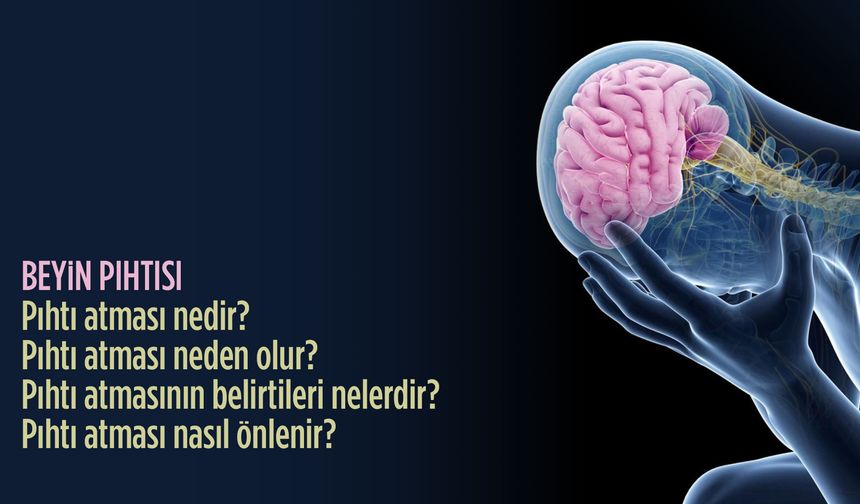 Pıhtı atması salgın gibi büyüyor | Beyin pıhtısı nedir, neden olur, belirtileri nelerdir?