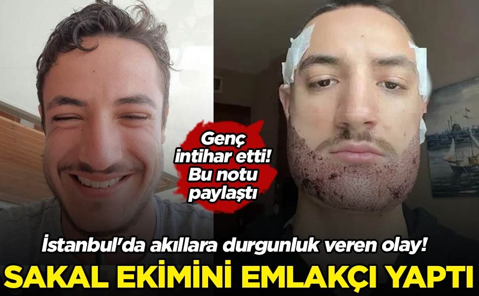 İstanbul'da akıllara durgunluk veren olay! Sakal ekimini doktor değil emlakçı yapmış! Genç intihar etti